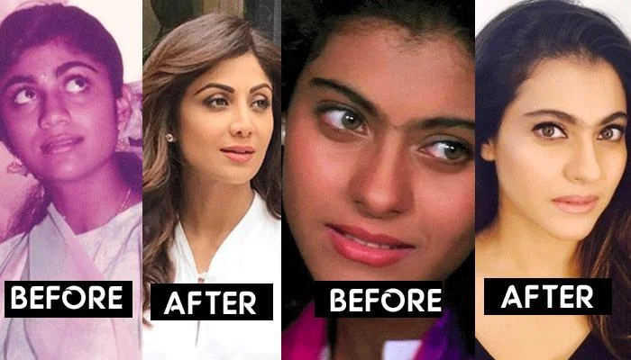 Bollwood celebs that went for skin lightening